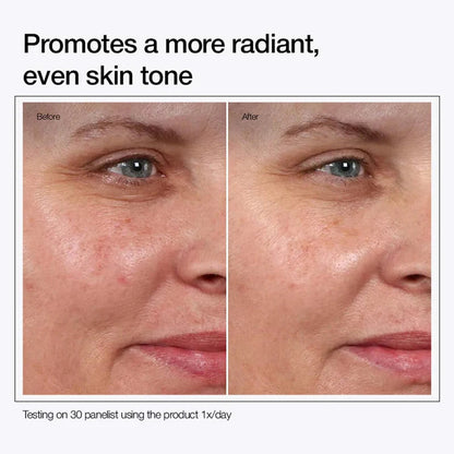 Urapra Glycolic Acid Body Care Duo ( BUY 1 GET 1 FREE )1699