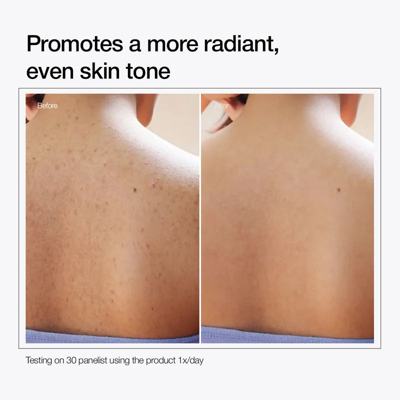 Urapra Glycolic Acid Body Care Duo ( BUY 1 GET 1 FREE )1699